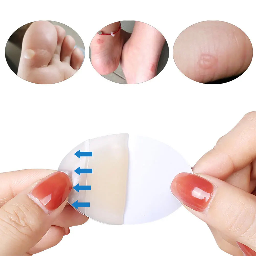 20/10pcs Hydrocolloid Foot Patch Heel Stickers